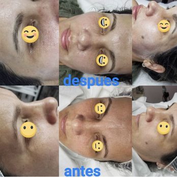 Facial Care With Yusi - Plasma - Skin Care Near Me - Miami, Florida Facial Care With Yusi - Plasma - Skin Care Near Me - Miami, Florida