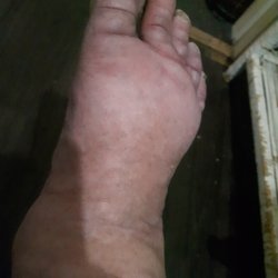 7-Eleven - This is my right foot. I will be a very lucky woman if i am able to even walk in my future. A lawyer may need to e contacted about this.