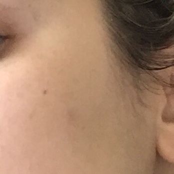 Priya Esthetics - Skin Care Near Me - Herndon, Virginia