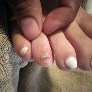 Rainbow Nails - 2nd out if 4 damaged nails on minor - Nail Salons Near Me - Inglewood, California Rainbow Nails - 2nd out if 4 damaged nails on minor - Nail Salons Near Me - Inglewood, California