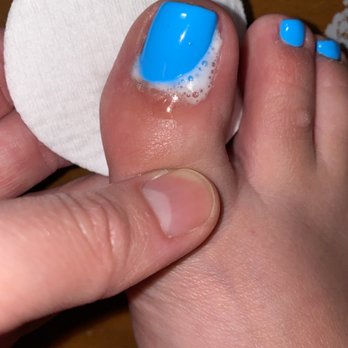 Yoyo Nail & Spa - Pedicure effected - Waxing Near Me - Hyattsville, Maryland