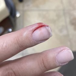 True Touch Nail & Spa - Bleeding all along the side. You can see the blood starting to fill under my nail.