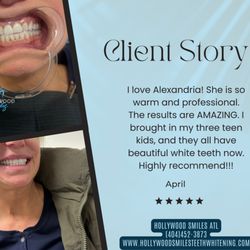 Hollywood Smiles Teeth Whitening