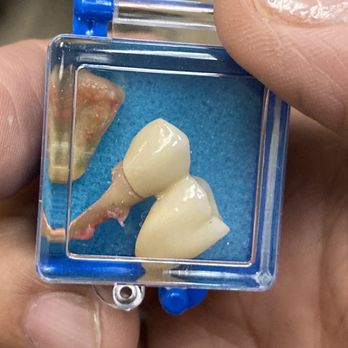 Lakeview Dental - The extraction was easy. Thank you Dr. Tran! - General Dentistry Near Me - Las Vegas, Nevada Lakeview Dental - The extraction was easy. Thank you Dr. Tran! - General Dentistry Near Me - Las Vegas, Nevada
