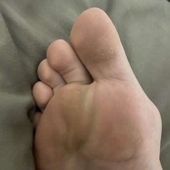 Gel Nails & Spa - Right after my pedi look at how bad my feet look - Nail Salons Near Me - Placentia, California Gel Nails & Spa - Right after my pedi look at how bad my feet look - Nail Salons Near Me - Placentia, California