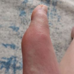 Advanced Foot And Ankle Specialists - Before seeing the doctor