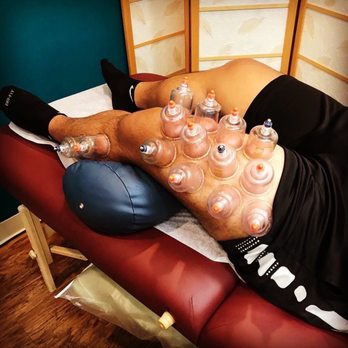 Ritual Acupuncture Center - Acupuncture Near Me - Vallejo, California Ritual Acupuncture Center - Acupuncture Near Me - Vallejo, California