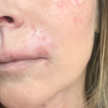 Fae Skin LV - Skin Care Near Me - Las Vegas, Nevada