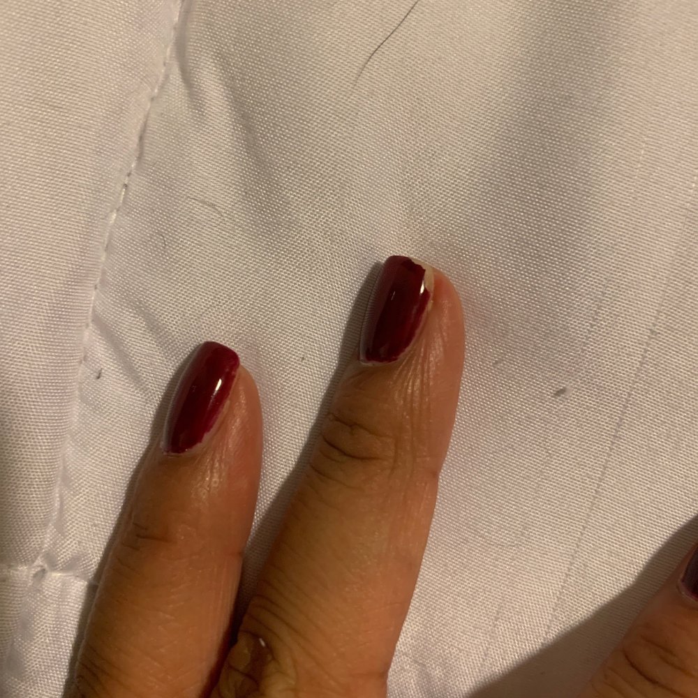 Chipped shellac. Two days later Chipped shellac. Two days later