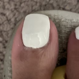 Hope the picture can capture the lumpiness of the acrylic and how it is not even properly applied around the cuticle.