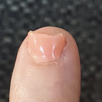 Upstate Nails - Broken uneven nail after gel extension came off on day 4! My natural nails were cut ridiculously short too - Nail Salons Near Me - Liverpool, New York Upstate Nails - Broken uneven nail after gel extension came off on day 4! My natural nails were cut ridiculously short too - Nail Salons Near Me - Liverpool, New York