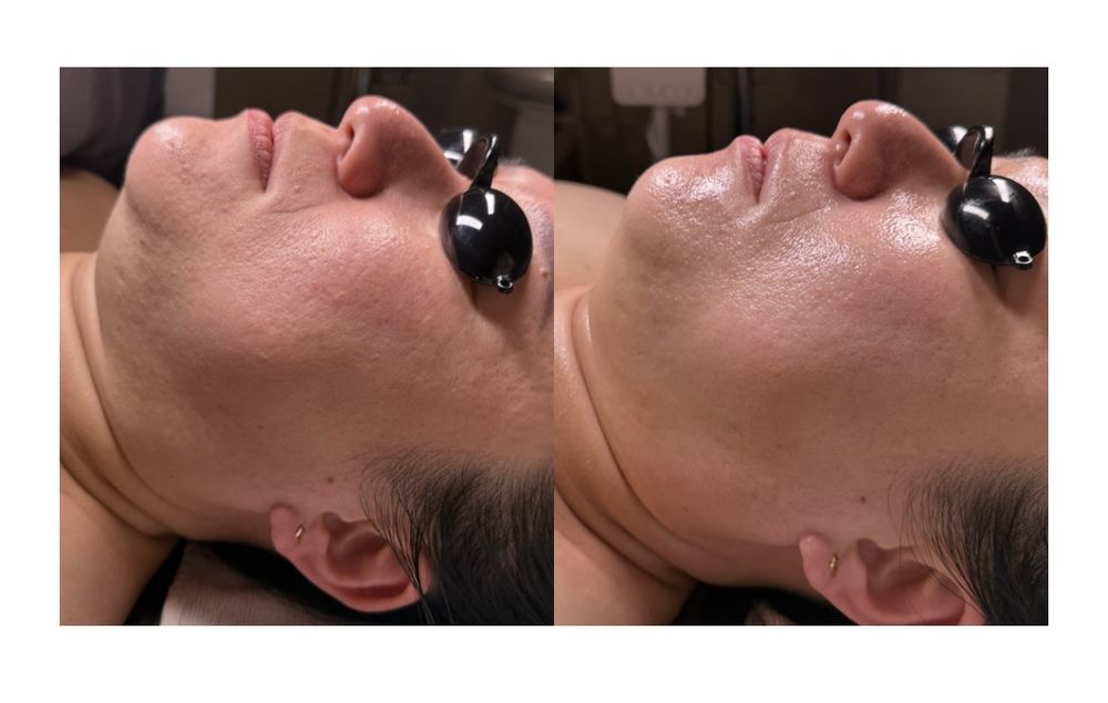 Glow Skin Therapy K-Beauty Facials Logo