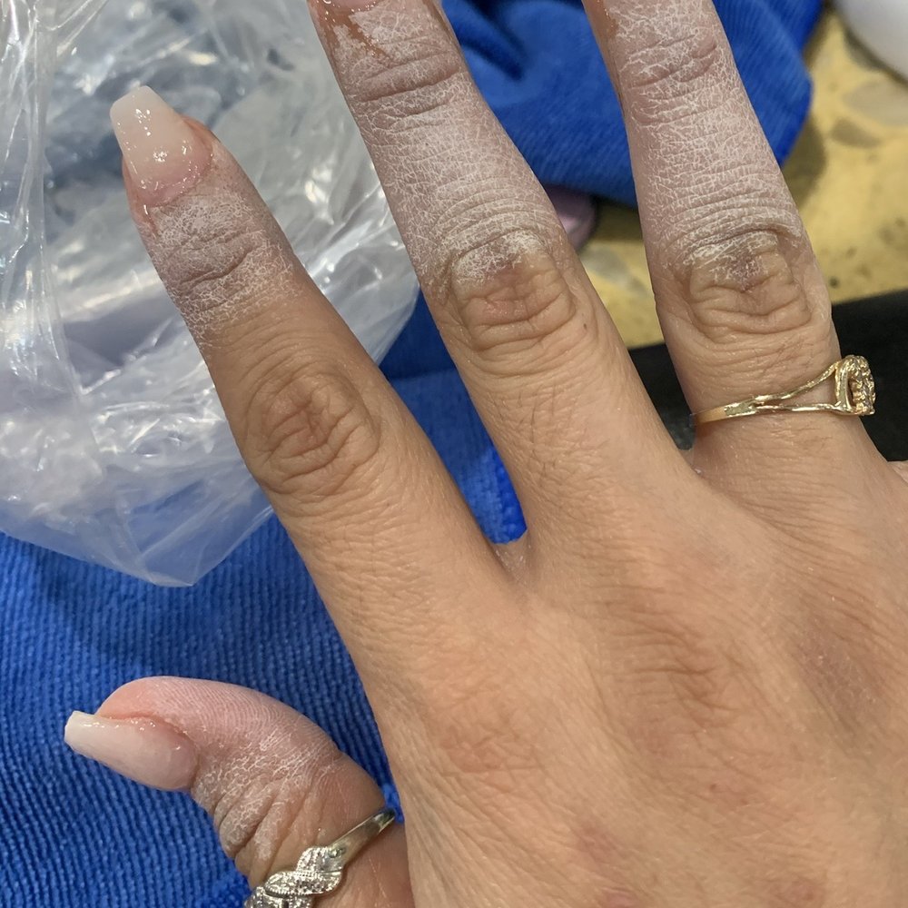 Lovely nails - How short my nails ended up after he went crazy with the nail filer! - Nail Salons Near Me - Menifee, California Lovely nails - How short my nails ended up after he went crazy with the nail filer! - Nail Salons Near Me - Menifee, California