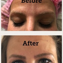 The Brow RN - Microblading