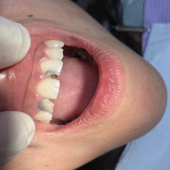 Olive Tree Dental - Dr. Saucedo did a life experience  transformation. Not only did he fix my smile he fixed my life! - General Dentistry Near Me - La Mirada, California
