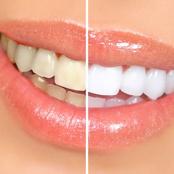 Orleans Dental Centre - General Dentistry Near Me - Orleans, Ontario Orleans Dental Centre - General Dentistry Near Me - Orleans, Ontario