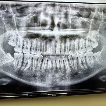 AZ Max Surgeons - Oral Surgeons Near Me - Mesa, Arizona