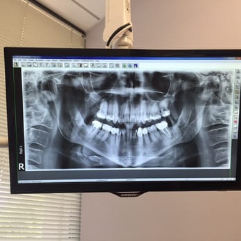 Smile Galleria - Monitor that doubles as a TV. I got to watch HGTV while my teeth were being cleaned. How awesome is that? - Cosmetic Dentists Near Me - McLean, Virginia Smile Galleria - Monitor that doubles as a TV. I got to watch HGTV while my teeth were being cleaned. How awesome is that? - Cosmetic Dentists Near Me - McLean, Virginia