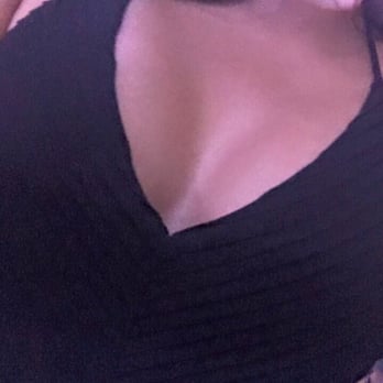 Prime Plastic Surgery - 6 weeks after surgery. No bra enjoying front row seats at a Ja Rule Concert. The girls look amazing - Cosmetic Surgeons Near Me - La Mesa, California