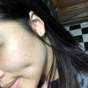Face Reality Acne Clinic - Skin Care Near Me - San Ramon, California