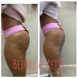 K Sage Scrubs & Spa Centre - Real results!! First visit!!