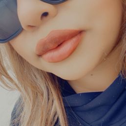 Lip filler Lip filler