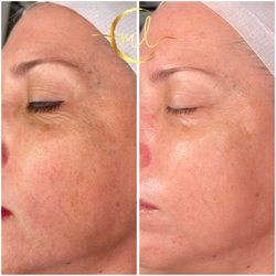 ML Skincare Center - Detox !