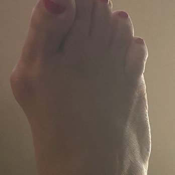 Dollard Mark, DPM - Before and after photos - Podiatrists Near Me - Sterling, Virginia