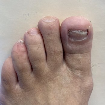 Concierge Podiatry and Spa - Before - Nail Salons Near Me - Costa Mesa, California Concierge Podiatry and Spa - Before - Nail Salons Near Me - Costa Mesa, California