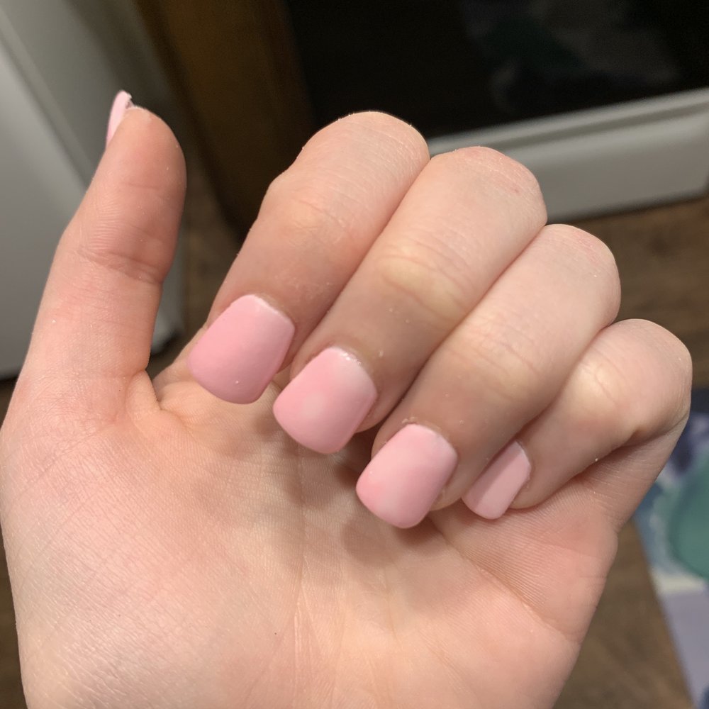 Blotchy nail color Blotchy nail color