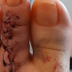 Kevin Richard Dux, DPM - Dr Dukes ghastly idea of an incision