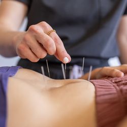 Willow Tree Acupuncture and Wellness Clinic - Pelvic floor acupuncture, providing effective treatment for pelvic pain, pelvic floor dysfunction, painful intercourse. Gentle, non invasive