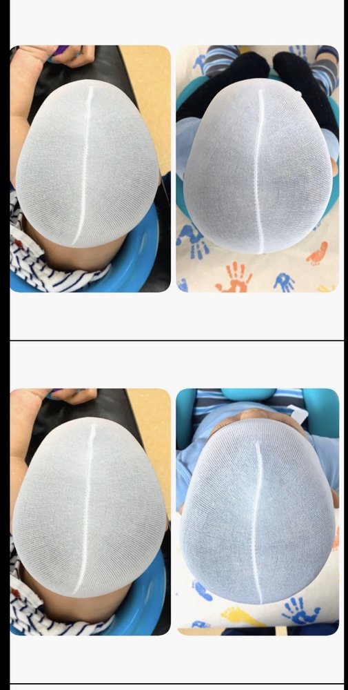 CHILDREN’S ORTHOTICS AND PROSTHETICS Updated April 2024 94 Photos & 33 Reviews 810 S