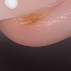 Lucky Nail Salon - The infections