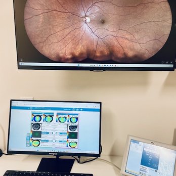 Chestnut Hill Eye Associates - Latest diagnostic equipment including retinal imaging and corneal wavefront - Optometrists Near Me - Philadelphia, Pennsylvania Chestnut Hill Eye Associates - Latest diagnostic equipment including retinal imaging and corneal wavefront - Optometrists Near Me - Philadelphia, Pennsylvania