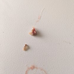 Gentle Touch Dental