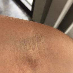 Not gentle taking blood out