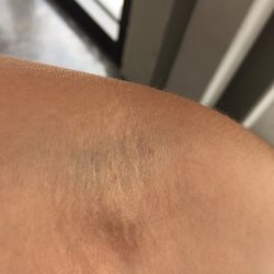 LabCorp - Not gentle taking blood out