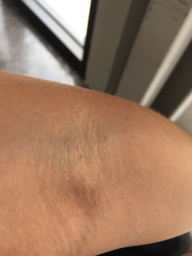 LABCORP Updated October 2024 14 Reviews 4201 Palm Ave, Hialeah