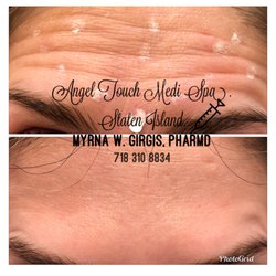 Angel Touch Medi Spa Staten Island