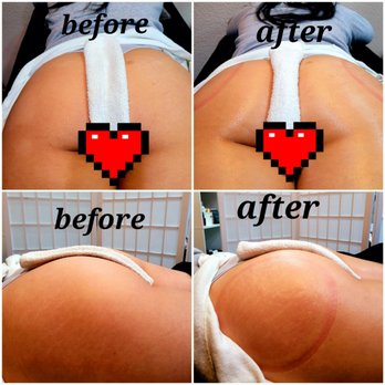 Mystic Moon Esthetics - Vacuum booty lift - Skin Care Near Me - Fresno, California Mystic Moon Esthetics - Vacuum booty lift - Skin Care Near Me - Fresno, California