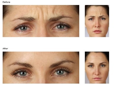 Ave Medical Laser Spa