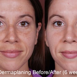 Westport Medispa - Dana Brownell, MD