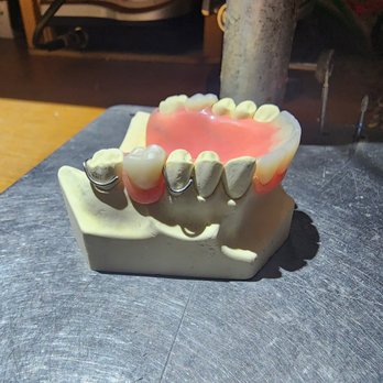 Smile Wide Dentures - General Dentistry Near Me - Scarborough, Ontario Smile Wide Dentures - General Dentistry Near Me - Scarborough, Ontario