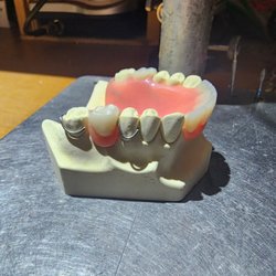 Smile Wide Dentures