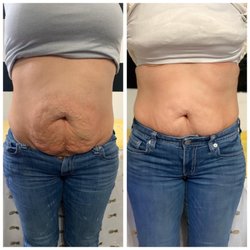 The Monroe Effect Sculpted by Kelsey - Toning and tightening the tummy area with this beautiful mama.