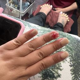 My nails where yellow n not white like I wanted for Christmas My nails where yellow n not white like I wanted for Christmas