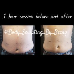 Body Sculpting By Becky - Procedure: Cavitation, Radio Frequency & Laser Lipo. 1 hour session.