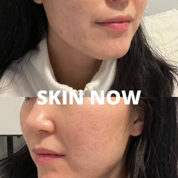 Aesthetic OOGII - Skin Care Near Me - San Francisco, California Aesthetic OOGII - Skin Care Near Me - San Francisco, California