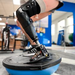 A Step Ahead Prosthetics